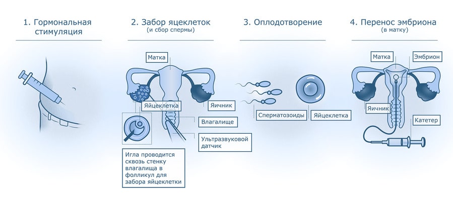 Фото: Гистероскопия и беременность посредством ЭКО